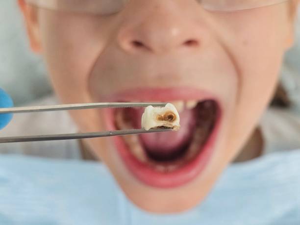 Best Cosmetic Emergency Dentistry in Dickson, TN